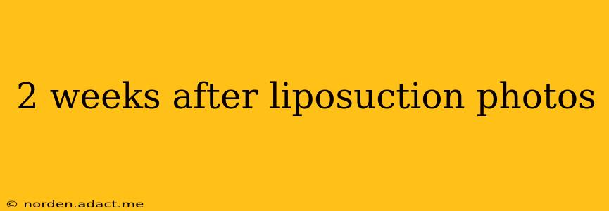 2 weeks after liposuction photos