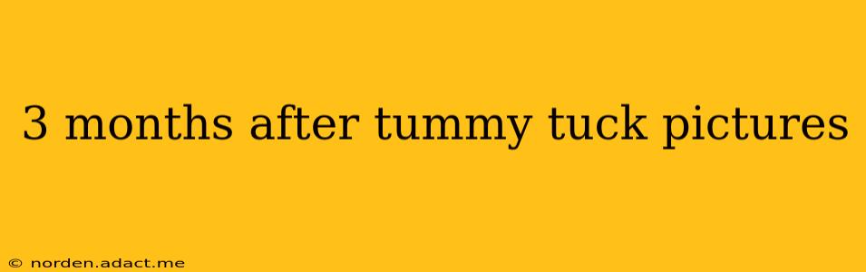 3 months after tummy tuck pictures
