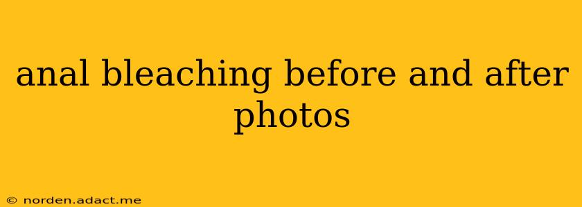 anal bleaching before and after photos