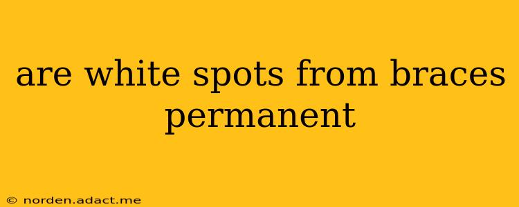 are white spots from braces permanent
