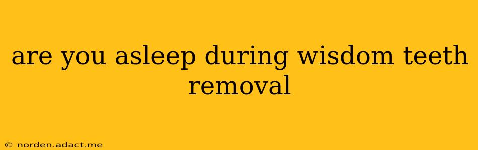 are you asleep during wisdom teeth removal