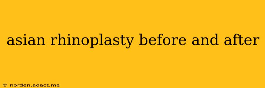 asian rhinoplasty before and after