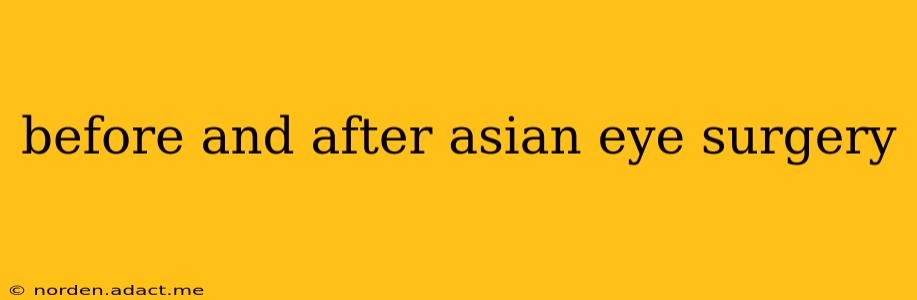 before and after asian eye surgery