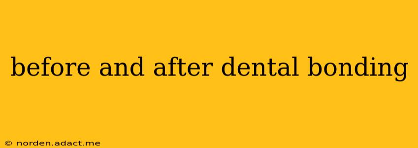 before and after dental bonding