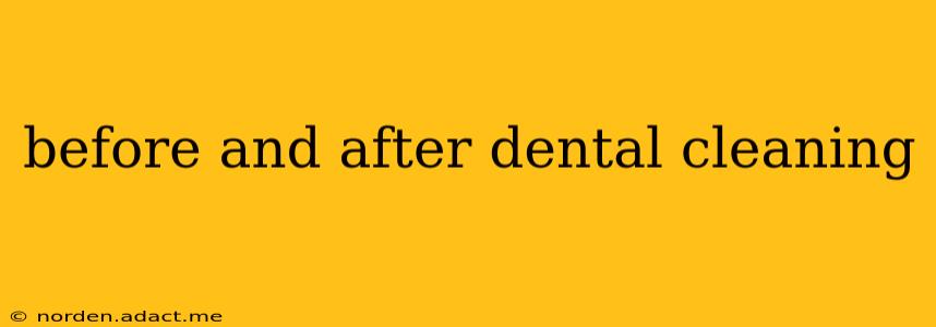 before and after dental cleaning