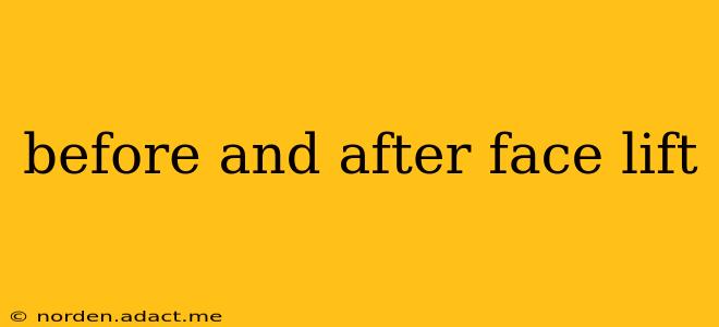 before and after face lift