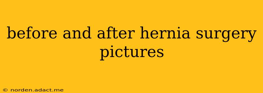 before and after hernia surgery pictures