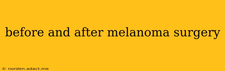 before and after melanoma surgery