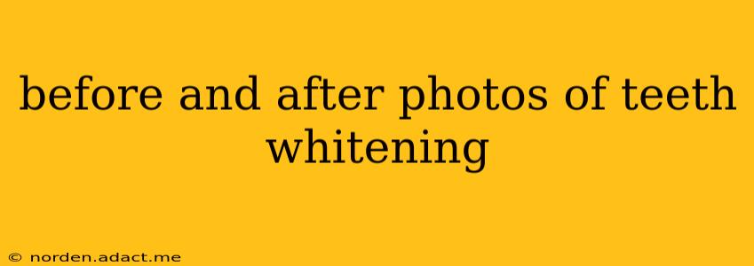 before and after photos of teeth whitening