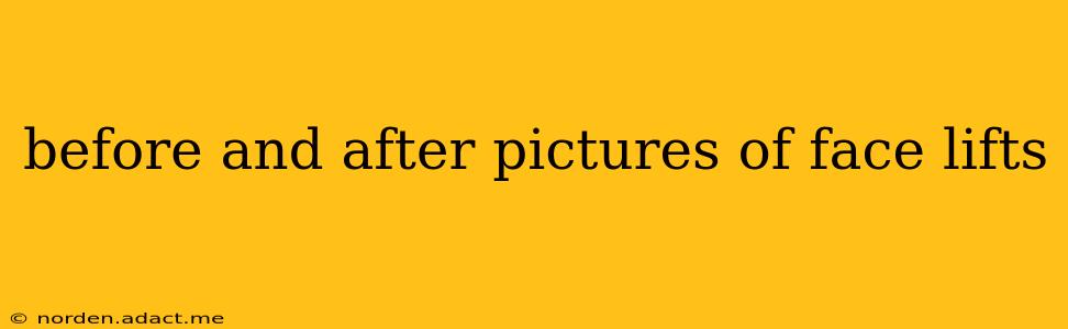 before and after pictures of face lifts