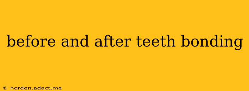 before and after teeth bonding