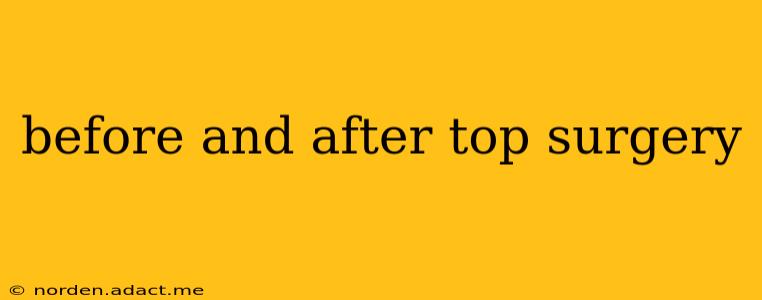 before and after top surgery