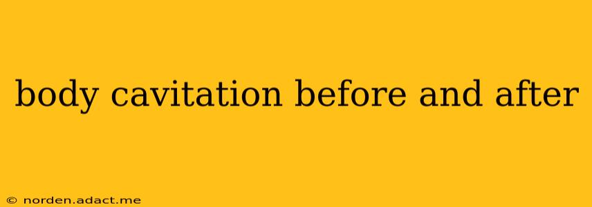 body cavitation before and after