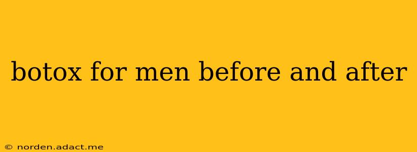 botox for men before and after