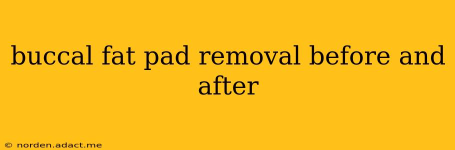 buccal fat pad removal before and after