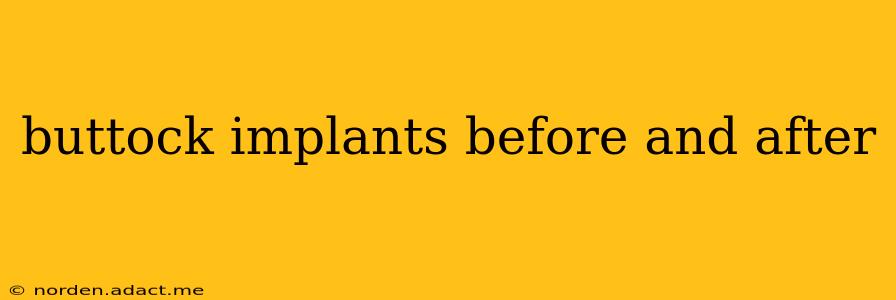 buttock implants before and after