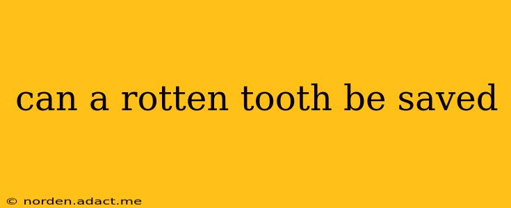 can a rotten tooth be saved