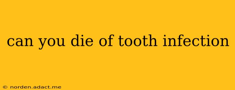 can you die of tooth infection