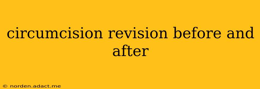 circumcision revision before and after