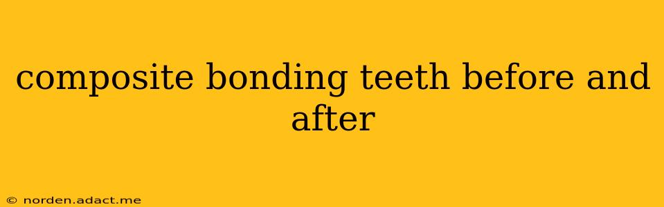 composite bonding teeth before and after