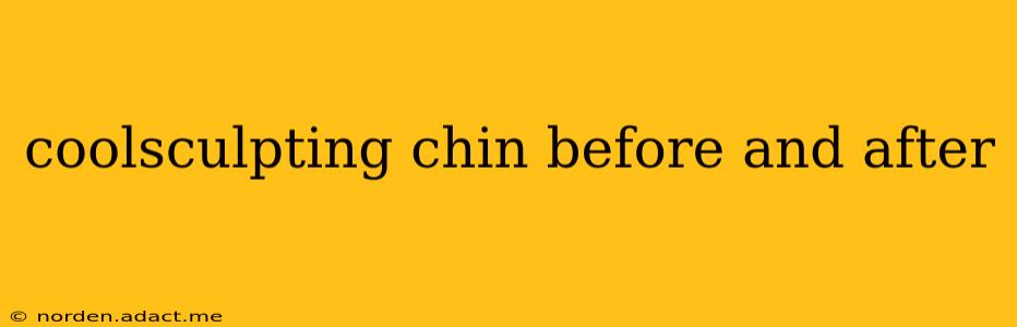 coolsculpting chin before and after