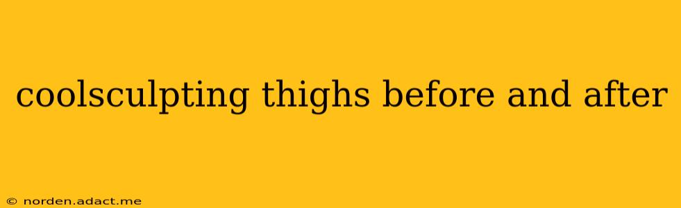 coolsculpting thighs before and after