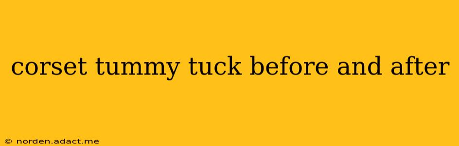 corset tummy tuck before and after