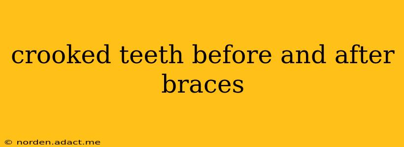 crooked teeth before and after braces