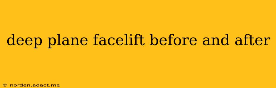 deep plane facelift before and after