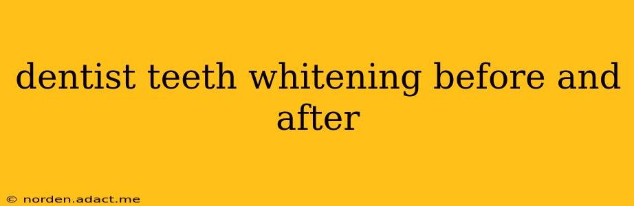 dentist teeth whitening before and after