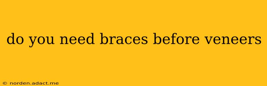 do you need braces before veneers