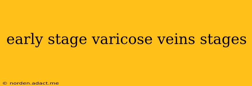 early stage varicose veins stages