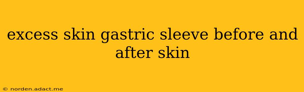excess skin gastric sleeve before and after skin