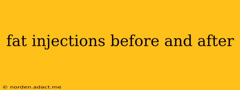 fat injections before and after