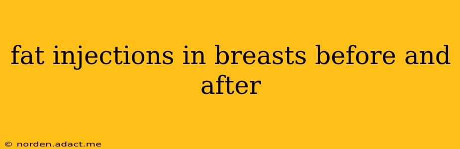 fat injections in breasts before and after