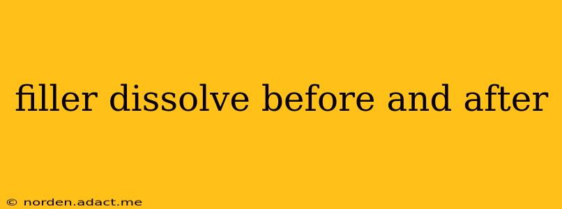 filler dissolve before and after