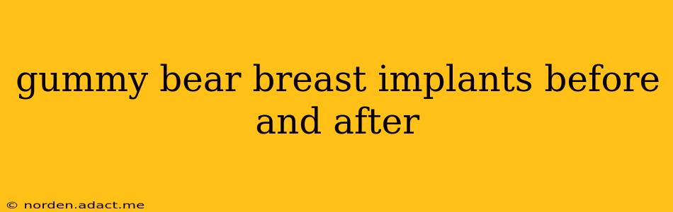 gummy bear breast implants before and after
