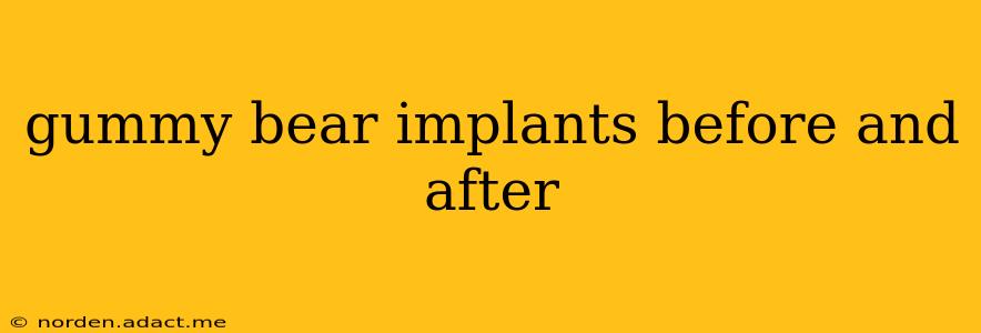 gummy bear implants before and after