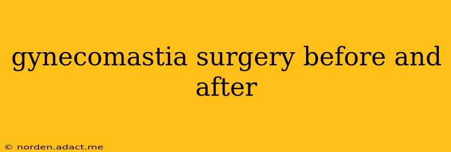 gynecomastia surgery before and after
