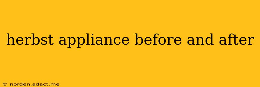 herbst appliance before and after