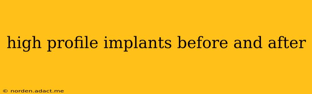 high profile implants before and after