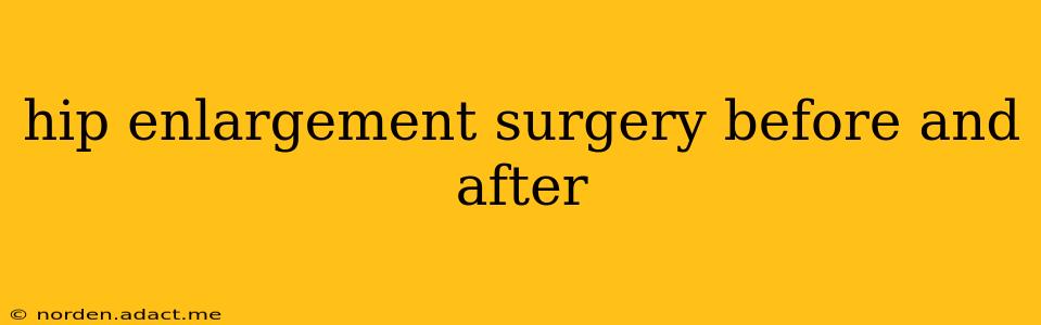 hip enlargement surgery before and after