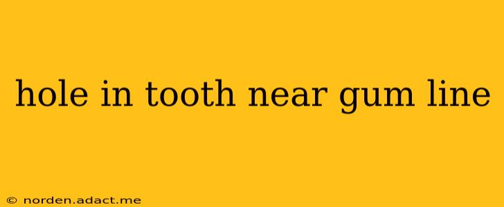 hole in tooth near gum line