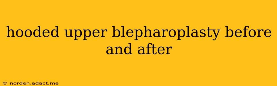 hooded upper blepharoplasty before and after