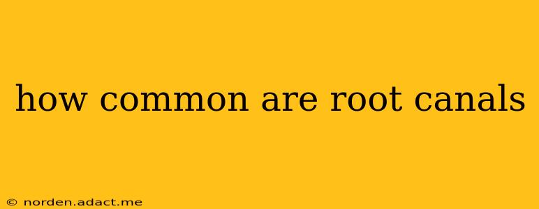 how common are root canals