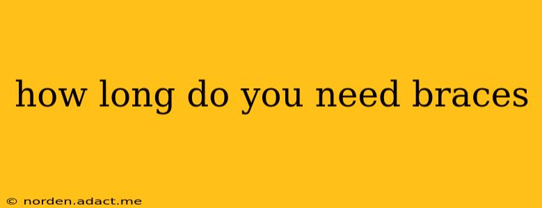 how long do you need braces