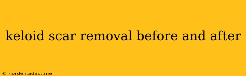 keloid scar removal before and after