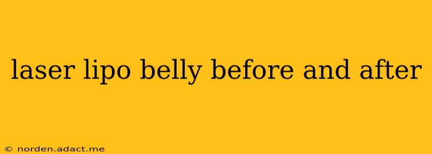 laser lipo belly before and after