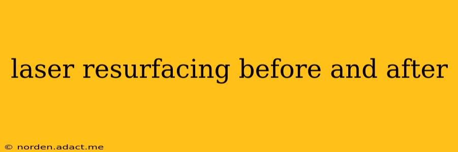 laser resurfacing before and after