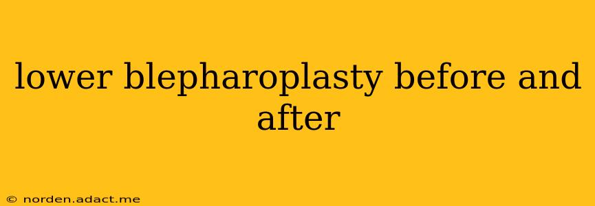 lower blepharoplasty before and after
